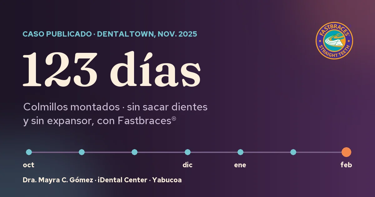 123 días: caso publicado de Fastbraces® sin extracciones ni expansor