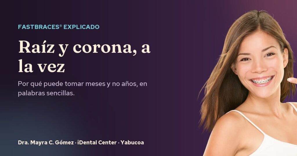 Brackets Fastbraces® explicados en palabras sencillas